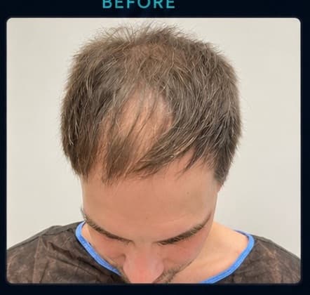 Patient photograph before the procedure